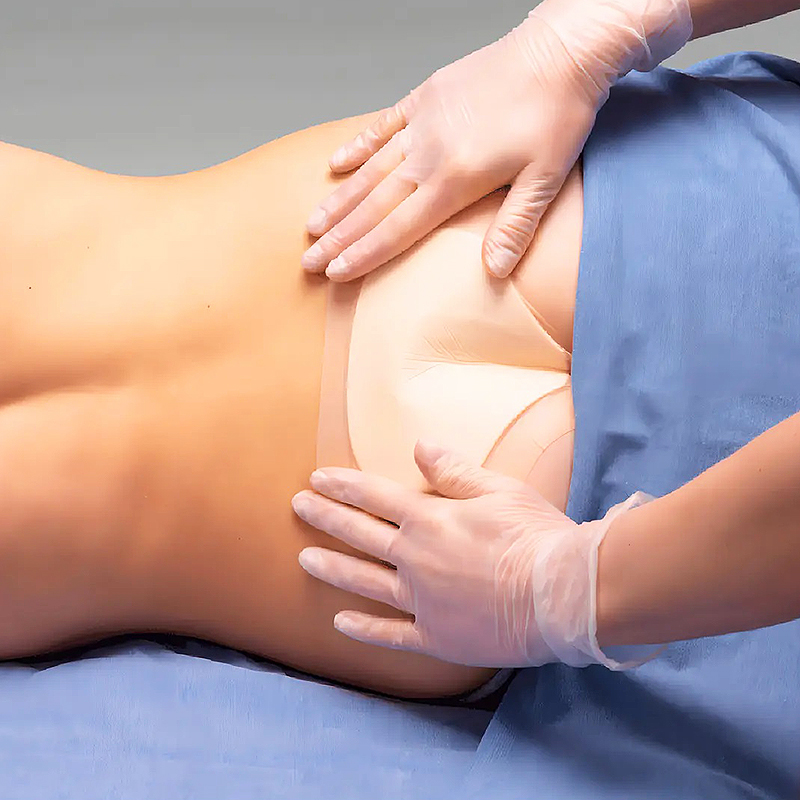 Curativo Sacral com Alta Absorção de Exsudato - Aquacel Foam Pro Convatec
